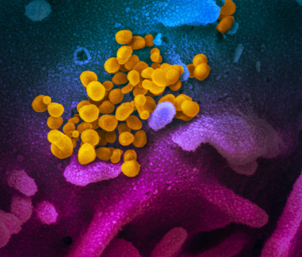coronavirus in Northern Italy